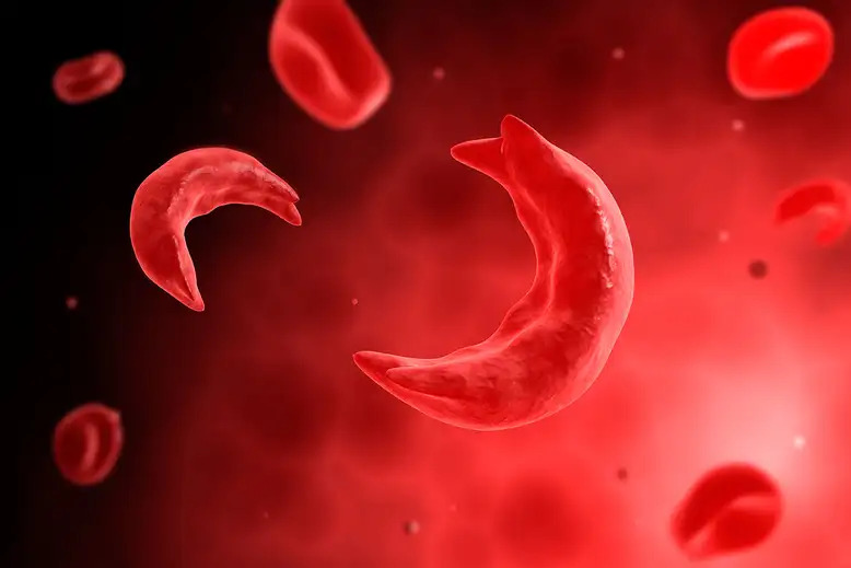Blood Disorders-Explained 1 d9nr75 web
